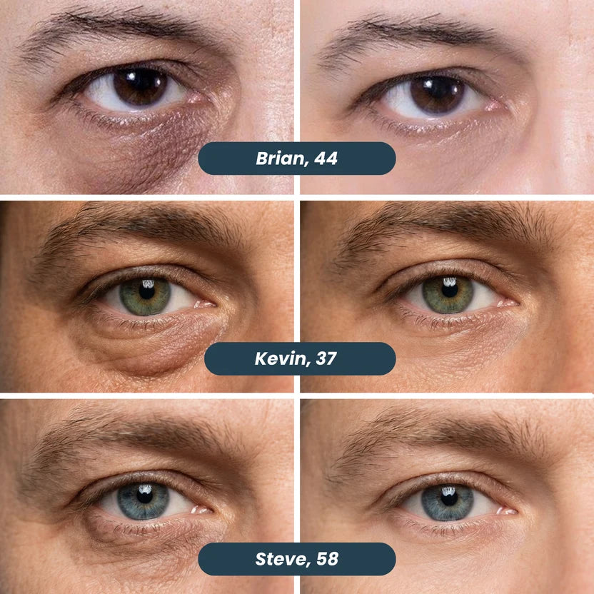 Hydrolyzed Collagen Anti-wrinkle Cream