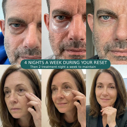 Microneedle Under-Eye Patches